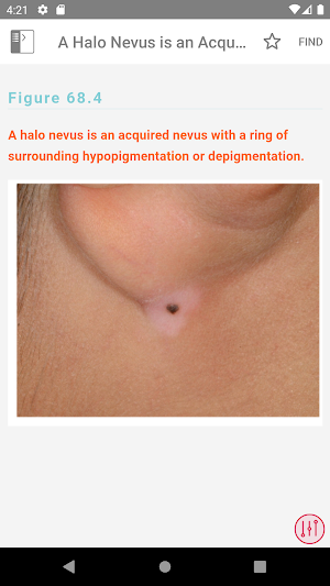 Pediatric Dermatology: A Quick Reference Guide Screenshot 3