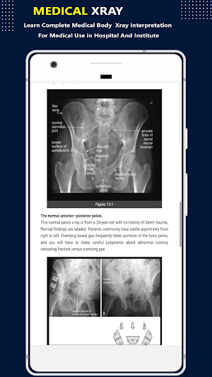 X-Ray Interpretation Guide Screenshot 2
