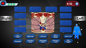 Gamifying Anatomy Screenshot 3