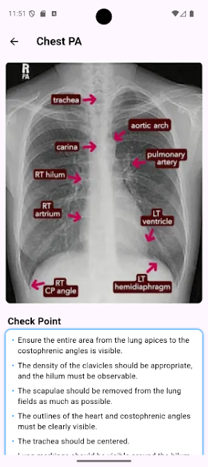 RadPosition: X-ray Positioning Screenshot 3