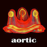 ViV Aortic