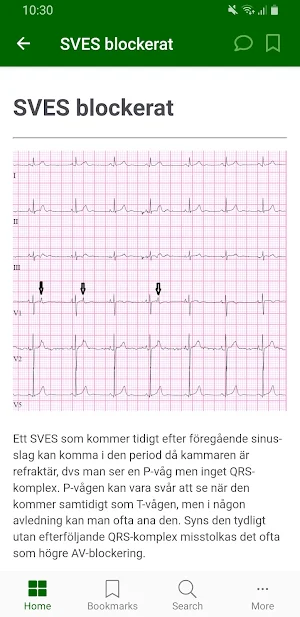 EKG-Appen Screenshot 3