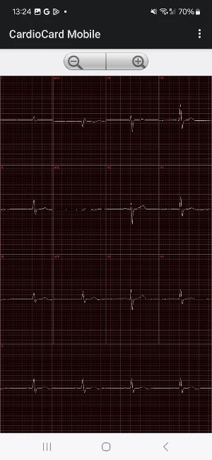 Nasiff CardioCard Mobile Screenshot 3