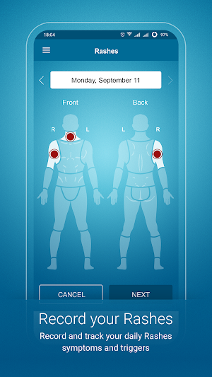 Psoriasis Monitor Screenshot 2