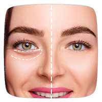 How To Get Rid Of Eye Bags