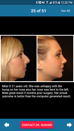 Plastic Surgery in Sydney Screenshot 1