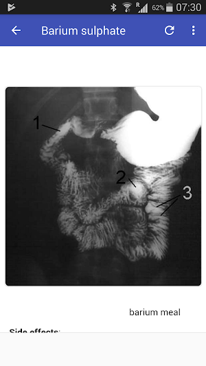Contrast Media in Radiology Screenshot 1
