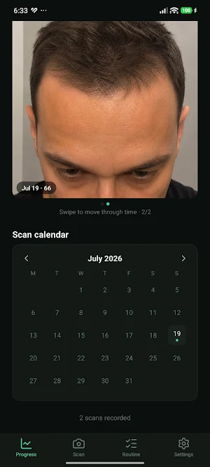 HairProof: Hair Loss Tracker Screenshot 2