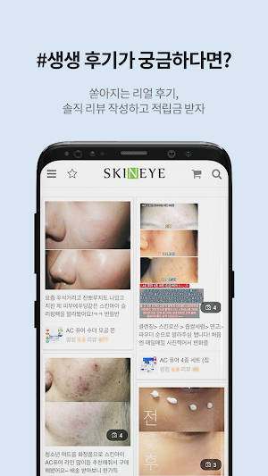 스킨아이 - skineye Screenshot 3