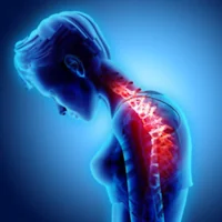 kyphosis exercise rounded back