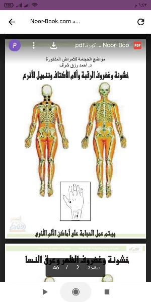 مواضع الحجامة Screenshot 0