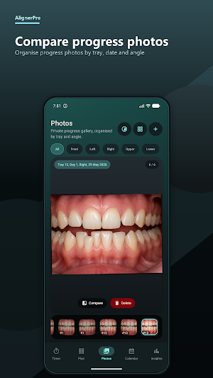 AlignerPro: Aligner Tracker Screenshot 3