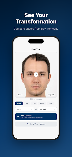 HairGrowth: Transplant Tracker Screenshot 2