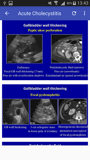 Ultrasound Of Gallbladder Screenshot 2