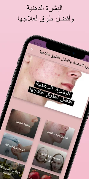 البشرة الدهنية وطرق لعلاجها Screenshot 0
