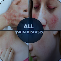 Skin Diseases & Treatment