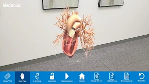 Melody™ TPV AR Screenshot 1
