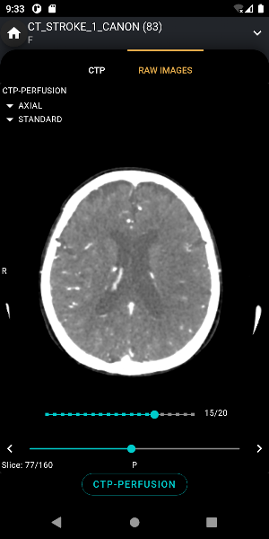 S.I.A Neurovascular Care Screenshot 3