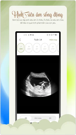 Cẩm Nang Bà Bầu & Em Bé 2025 Screenshot 1