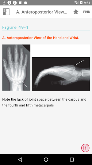 Visual Diagnosis in Emergency & Critical Care Medi Screenshot 3
