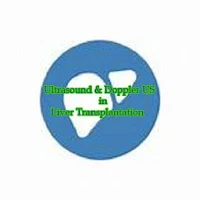 Doppler in Liver Transplant