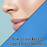 How To Get Rid Of Clogged Pores Naturally