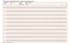 ECG Recorder Screenshot 0