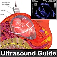 Ultrasound Guide a to z
