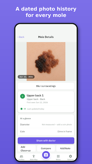 Holey Mole - Scan and Track Screenshot 1