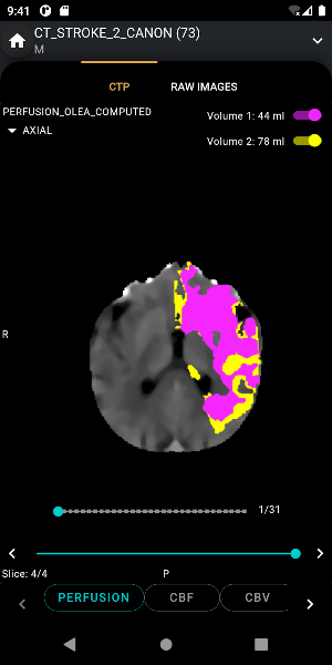S.I.A Neurovascular Care Screenshot 0