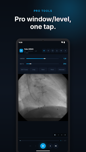 Radix DICOM Viewer: CT & MRI Screenshot 2