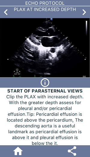 LEARN THE FULL TTE ECHO ULTRASOUND PROTOCOL Screenshot 1