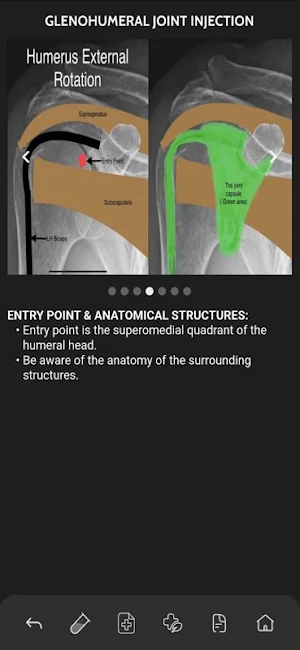 VBS RadGuide: MSK Injections Screenshot 3
