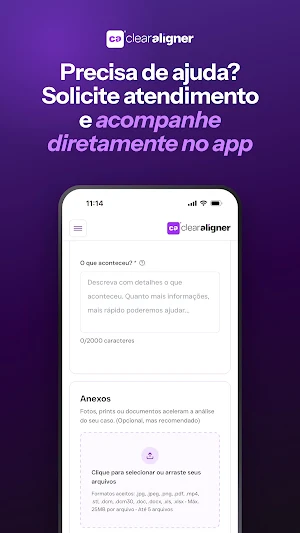 CA Clear Aligner Screenshot 3