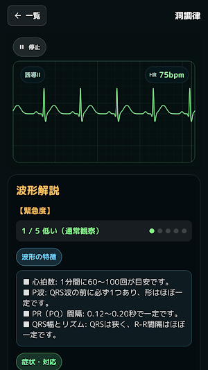 モニター心電図トレーニング Screenshot 2