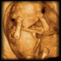 BCM OB Ultrasound