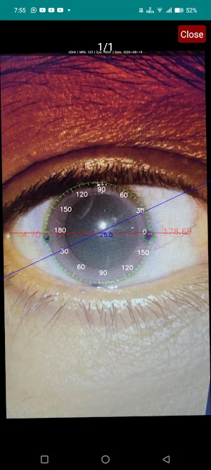 Precision everywhere Screenshot 2