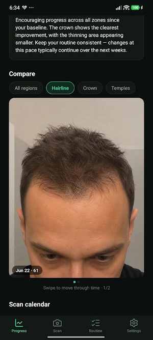HairProof: Hair Loss Tracker Screenshot 3