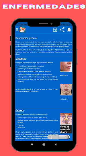 Enfermedades de la Piel en Español Screenshot 3