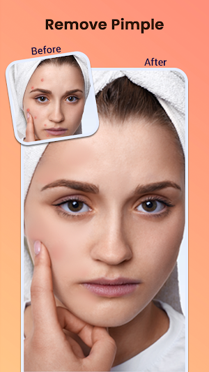 Pimple Remover - Beauty Face Screenshot 0