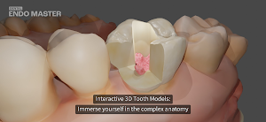 Dental EndoMaster Screenshot 1
