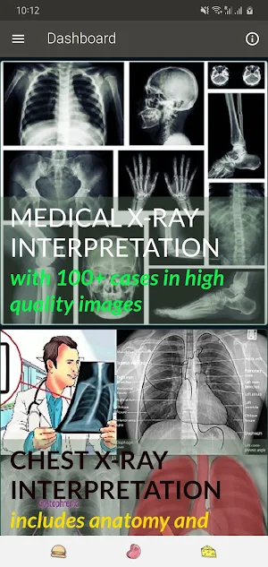 Medical X-RAY Interpretations with over 120+ cases Screenshot 0