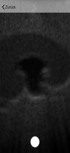 Ultraschall Screenshot 0