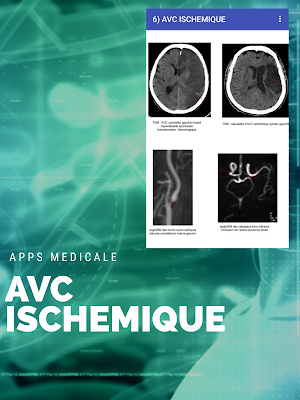 radio-anatomie"scanner cérébral" Screenshot 3