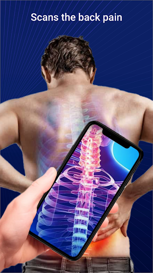 X-Ray Scanner : XRay Filter AI Screenshot 2