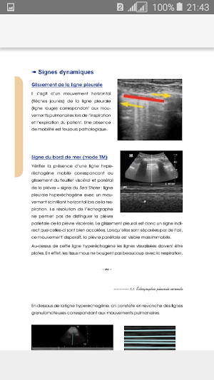 Guide d’Échographie Screenshot 2