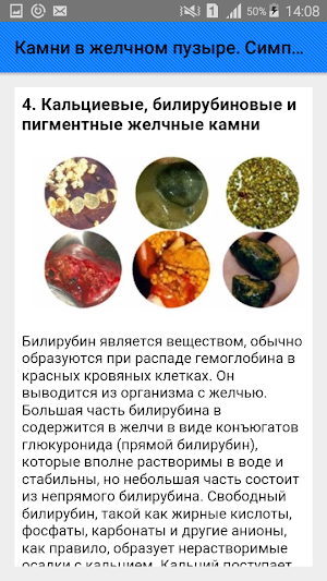 Камни в желчном пузыре. Симптомы и советы Screenshot 3