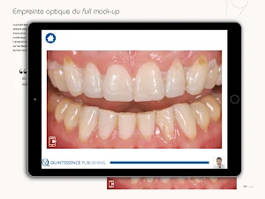 Quintessence Koubi Screenshot 1