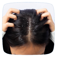 How To Get Rid Of Dandruff