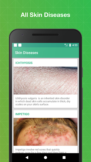 All Skin Diseases and Treatments - Skin care guide Screenshot 0